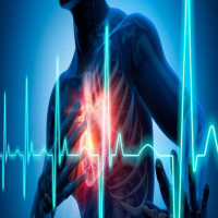Avatar de ArretDuCoeur