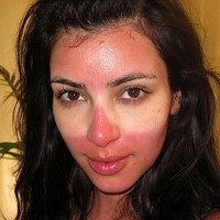 Avatar de CoupDeSoleil
