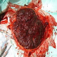 Avatar de ResiduPlacenta